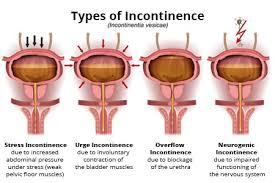 incontinence
