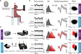 Extension neurosensing